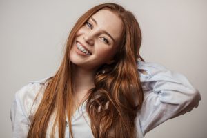 Myths About Braces Debunked