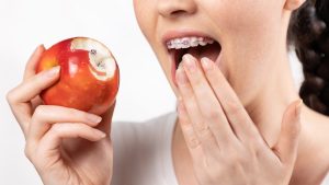 food you can't eat with braces